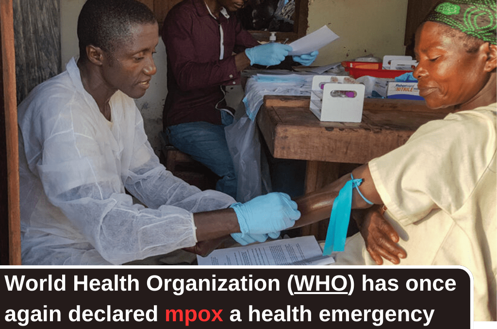 Everything You Need to Know About the Mpox Outbreak: Next Global Health Emergency